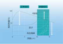 質(zhì)子治療兒童腫瘤一文詳解！